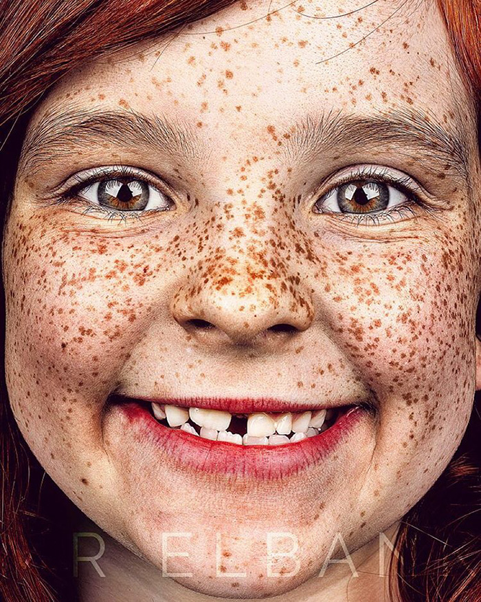 freckles-portrait-photography-brock-elbank-135__700